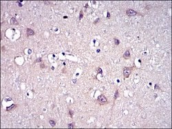 Invitrogen MMP9 Monoclonal Antibody (5G3) 100 &mu;L; Unconjugated:Antibodies,