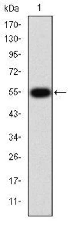 Invitrogen MMP9 Monoclonal Antibody (5G3) 100 &mu;L; Unconjugated:Antibodies,