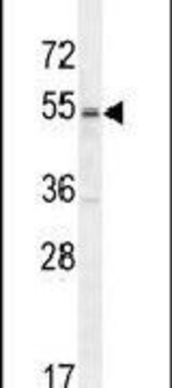 MPP1 Rabbit anti-Human, Polyclonal, Invitrogen 400 &mu;L; Unconjugated:Antibodies,
