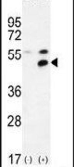 MPP1 Rabbit anti-Human, Polyclonal, Invitrogen 400 &mu;L; Unconjugated:Antibodies,
