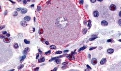 MRGPRX2 Polyclonal Antibody, Invitrogen 50 &mu;g | Buy Online | Thermo Scientific | Fisher Scientific