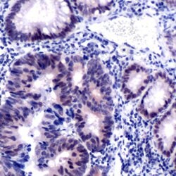 Invitrogen MSH2 Monoclonal Antibody (SP46) 500 &mu;L; Unconjugated:Antibodies,
