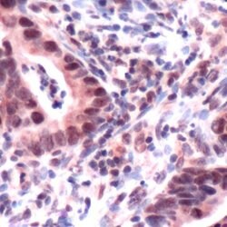 MSH3 Polyclonal Antibody:Antibodies, Polyclonal