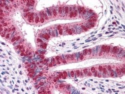 MUM1 Monoclonal Antibody (4G10), Invitrogen 100 &mu;L; Unconjugated:Antibodies,