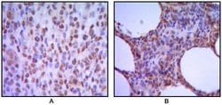 MUM1 Monoclonal Antibody (4G10), Invitrogen 100 &mu;L; Unconjugated:Antibodies,