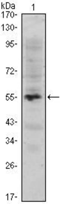 MUM1 Monoclonal Antibody (4G10), Invitrogen 100 &mu;L; Unconjugated:Antibodies,