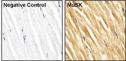 Invitrogen MUSK Polyclonal Antibody 200 &mu;g | Buy Online | Invitrogen&trade; | Fisher Scientific