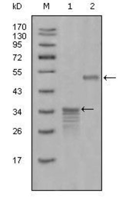 Invitrogen Mammaglobin A Monoclonal Antibody (1G8D6,2E7G9) 100 &mu;L; Unconjugated:Antibodies,