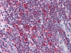 Invitrogen Metadherin Monoclonal Antibody (2F11C3) 100 &mu;L; Unconjugated:Antibodies,