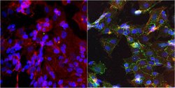 Invitrogen N-cadherin Monoclonal Antibody (8C11) 100 &mu;g; Unconjugated:Antibodies,
