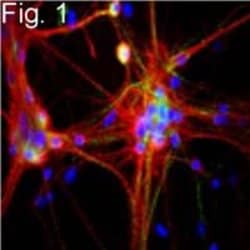 Invitrogen NEFL Monoclonal Antibody (DA2), Invitrogen™