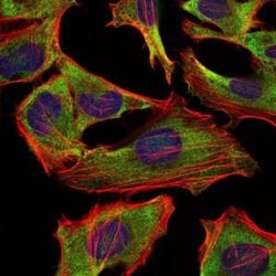 Invitrogen NEFL Monoclonal Antibody (1H3) 100 &mu;g; Unconjugated:Antibodies,
