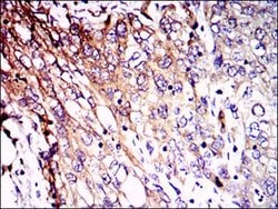 Invitrogen NEFL Monoclonal Antibody (1H3) 100 &mu;g; Unconjugated:Antibodies,