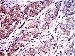 Invitrogen NEFL Monoclonal Antibody (1H3) 100 &mu;g; Unconjugated:Antibodies,
