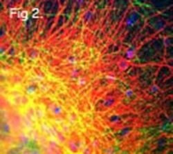Invitrogen NEFM Monoclonal Antibody (3H11) 100 μg; Unconjugated:Antibodies,