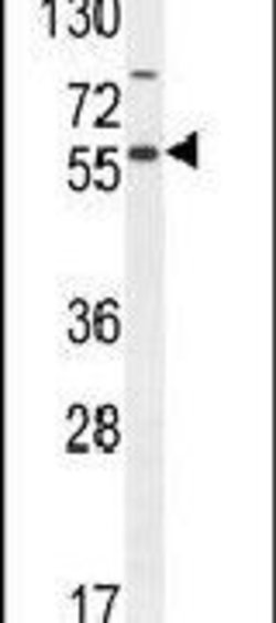 NFKBIL1 Rabbit anti-Human, Polyclonal, Invitrogen 400 &mu;L; Unconjugated:Antibodies,