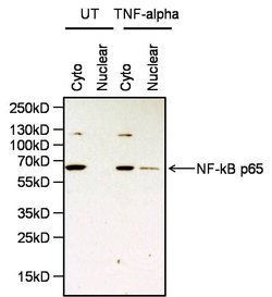 Invitrogen NFkB p65 Polyclonal Antibody 100 &mu;g; Unconjugated:Antibodies,