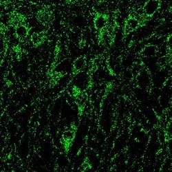 Invitrogen NMDAR1 Polyclonal Antibody 100 &mu;g | Buy Online | Invitrogen&trade; | Fisher Scientific