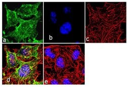Invitrogen NME2 Monoclonal Antibody (4G7A8) 100 &mu;g; Unconjugated:Antibodies,