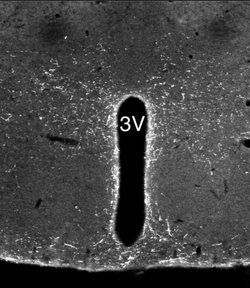 Invitrogen™ NPS Polyclonal Antibody