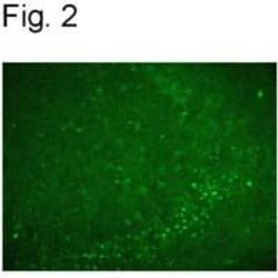 Nurr1 Polyclonal Antibody, Invitrogen 100 &mu;g; Unconjugated:Antibodies,