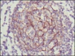 Invitrogen TrkC Monoclonal Antibody (7H6) 100 &mu;L; Unconjugated:Antibodies,