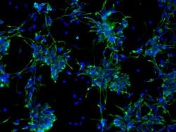 Invitrogen Nestin Monoclonal Antibody (10C2) 100 &mu;g; Unconjugated:Antibodies,