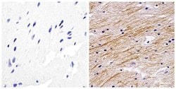 NEFL Monoclonal Antibody (DA2):Antikroppar