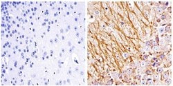 NEFL Monoclonal Antibody (DA2):Antikroppar