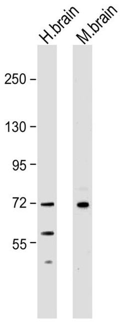 NEFL Monoclonal Antibody (DA2):Antikroppar