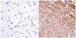 Invitrogen NEFL Monoclonal Antibody (DA2) 100 &mu;g; Unconjugated:Antibodies,