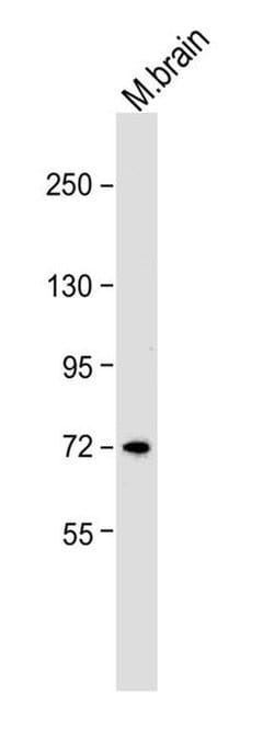 Invitrogen NEFL Monoclonal Antibody (DA2) 100 &mu;g; Unconjugated:Antibodies,