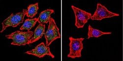 CHRNA1 Monoclonal Antibody (88B), Invitrogen 100 &mu;L; Unconjugated:Antibodies,