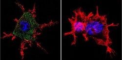 CHRNA1 Monoclonal Antibody (88B), Invitrogen 100 &mu;L; Unconjugated:Antibodies,