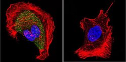 CHRNA1 Monoclonal Antibody (88B), Invitrogen 100 &mu;L; Unconjugated:Antibodies,