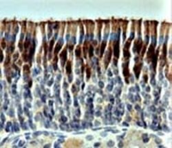 OMP Polyclonal Antibody, Invitrogen 100 &mu;L | Buy Online | Invitrogen | Fisher Scientific