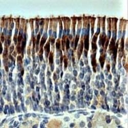 OMP Polyclonal Antibody, Invitrogen 100 &mu;L | Buy Online | Invitrogen | Fisher Scientific