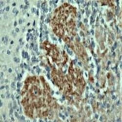 OMP Polyclonal Antibody, Invitrogen 100 &mu;L | Buy Online | Invitrogen | Fisher Scientific