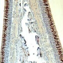 OMP Polyclonal Antibody, Invitrogen 100 &mu;L | Buy Online | Invitrogen | Fisher Scientific