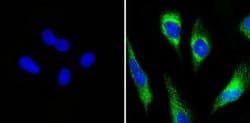 Invitrogen ERp72 Polyclonal Antibody 100 &mu;g; Unconjugated:Antibodies,