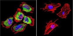 Invitrogen HSP27 Polyclonal Antibody 100 &mu;g; Unconjugated:Antibodies,