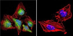 Invitrogen NFATC4 Polyclonal Antibody 100 &mu;g; Unconjugated:Antibodies,
