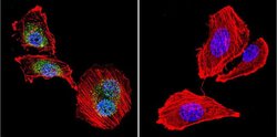 Invitrogen NFATC4 Polyclonal Antibody 100 &mu;g; Unconjugated:Antibodies,