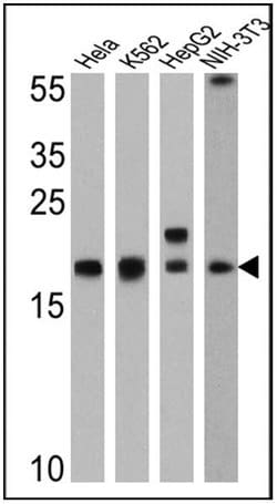 Invitrogen Cyclophilin A Polyclonal Antibody 400 &mu;L; Unconjugated:Antibodies,