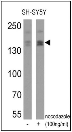 Invitrogen Phospho-nNOS (Ser1417) Polyclonal Antibody 100 &mu;g; Unconjugated:Antibodies,