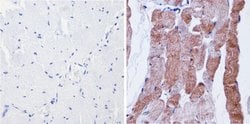 Invitrogen nNOS Polyclonal Antibody 100 &mu;g; Unconjugated:Antibodies,
