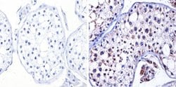 Invitrogen nNOS Polyclonal Antibody 100 &mu;g; Unconjugated:Antibodies,