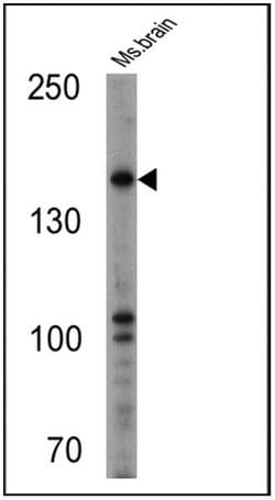 Invitrogen nNOS Polyclonal Antibody 100 &mu;g; Unconjugated:Antibodies,