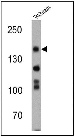Invitrogen nNOS Polyclonal Antibody 100 &mu;g; Unconjugated:Antibodies,