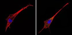 Invitrogen alpha-1a Adrenergic Receptor Polyclonal Antibody 100 &mu;L;